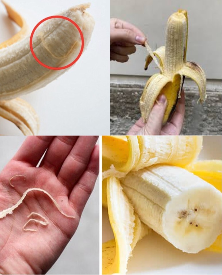 Phloem Bundles: Unwanted Strings on Your Banana