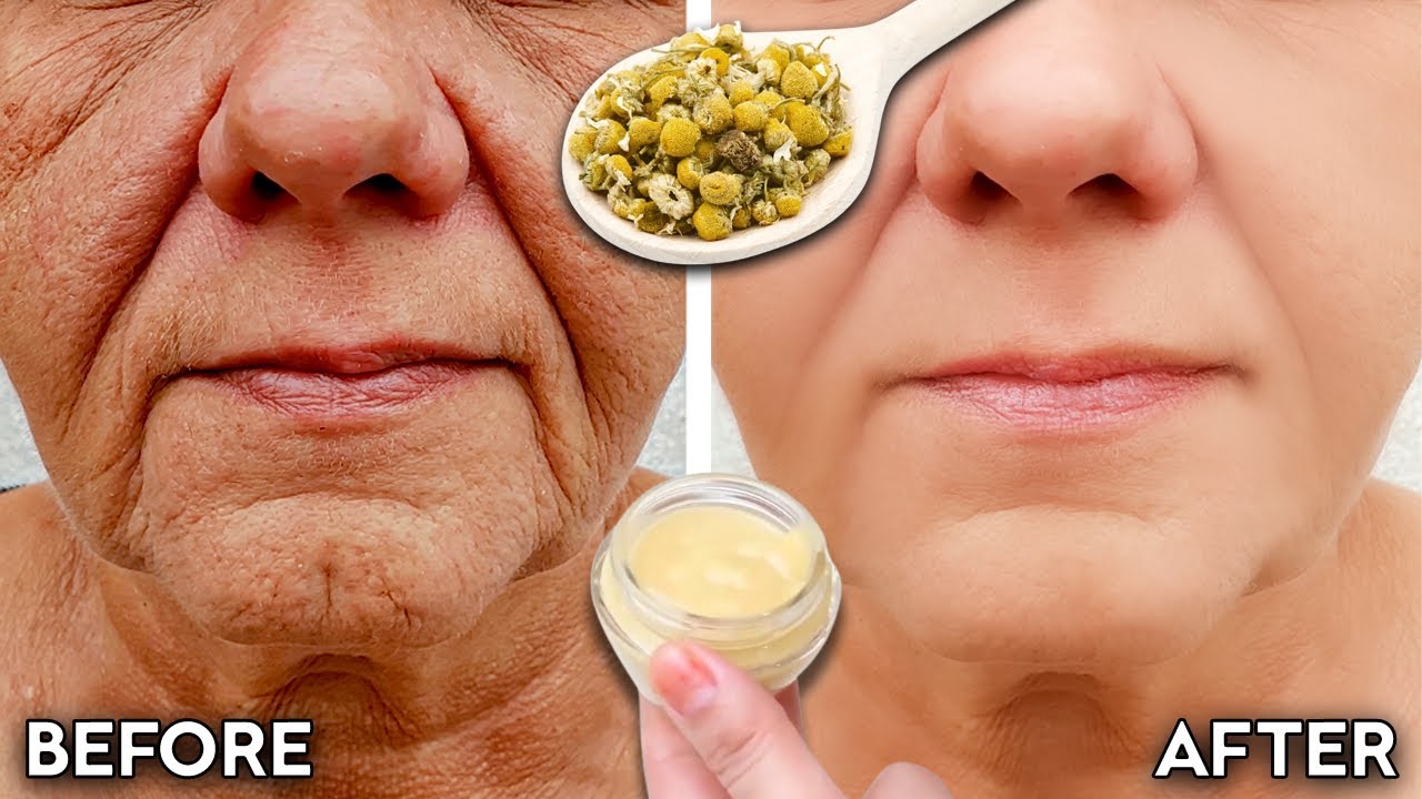 Say Goodbye to Wrinkles: Try This Natural Chamomile Cream for Youthful Skin!