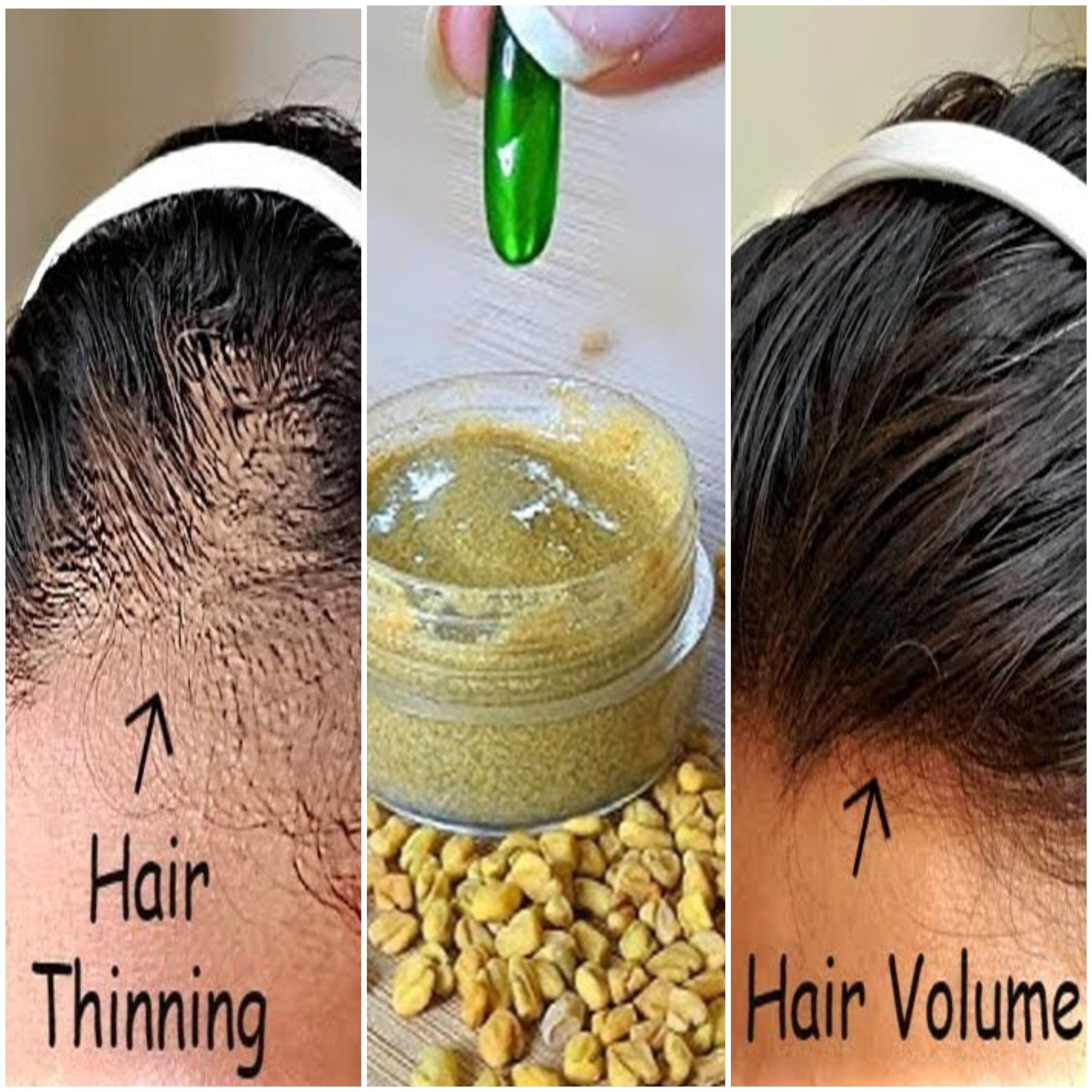 Vitamin E Oil for Hair: Benefits and How to Use It