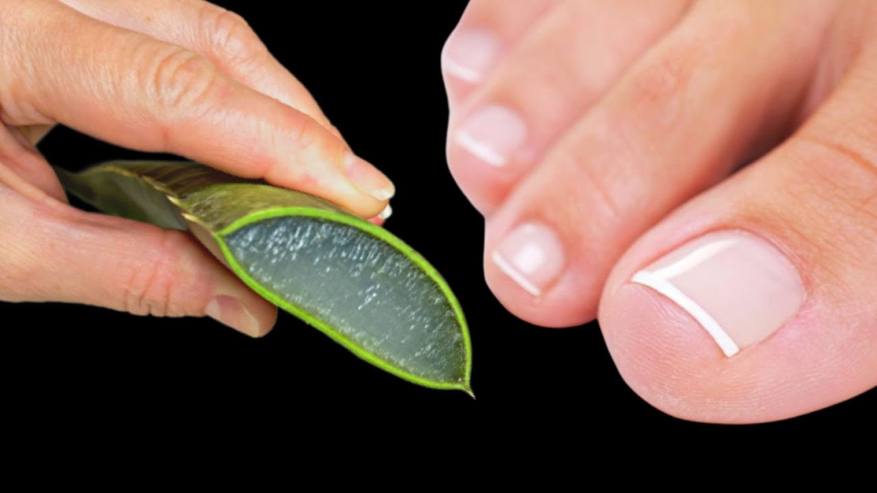 Discover the Healing Power of Aloe for Healthy Nails