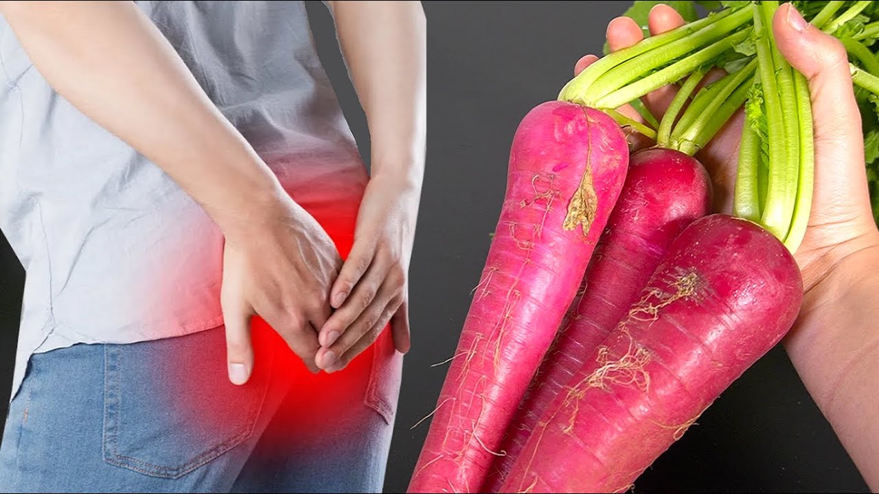 A Friendly Approach to Red Beet Hemorrhoid Relief