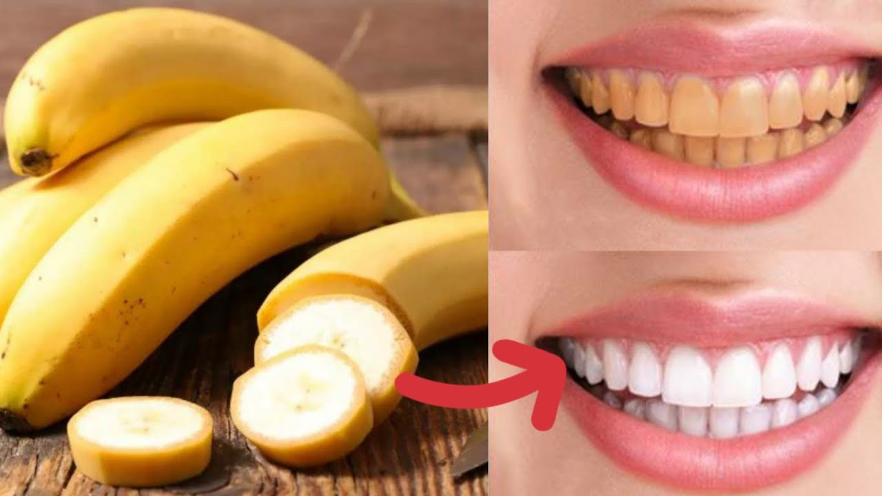 Achieve Brighter Smiles with DIY Teeth Whitening Recipes!