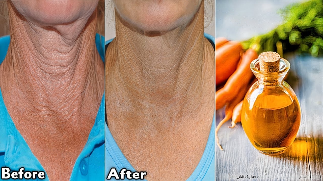 Discover the Secret to Youthful Skin: DIY Anti-Aging Treatment!