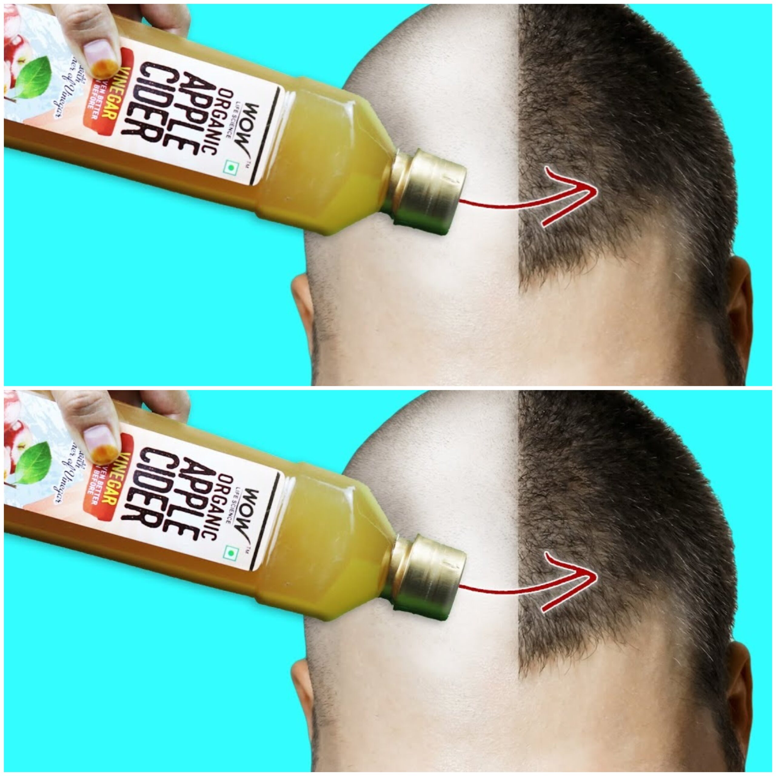 Unlocking the Magic of Apple Cider Vinegar for Healthy Hair and Skin