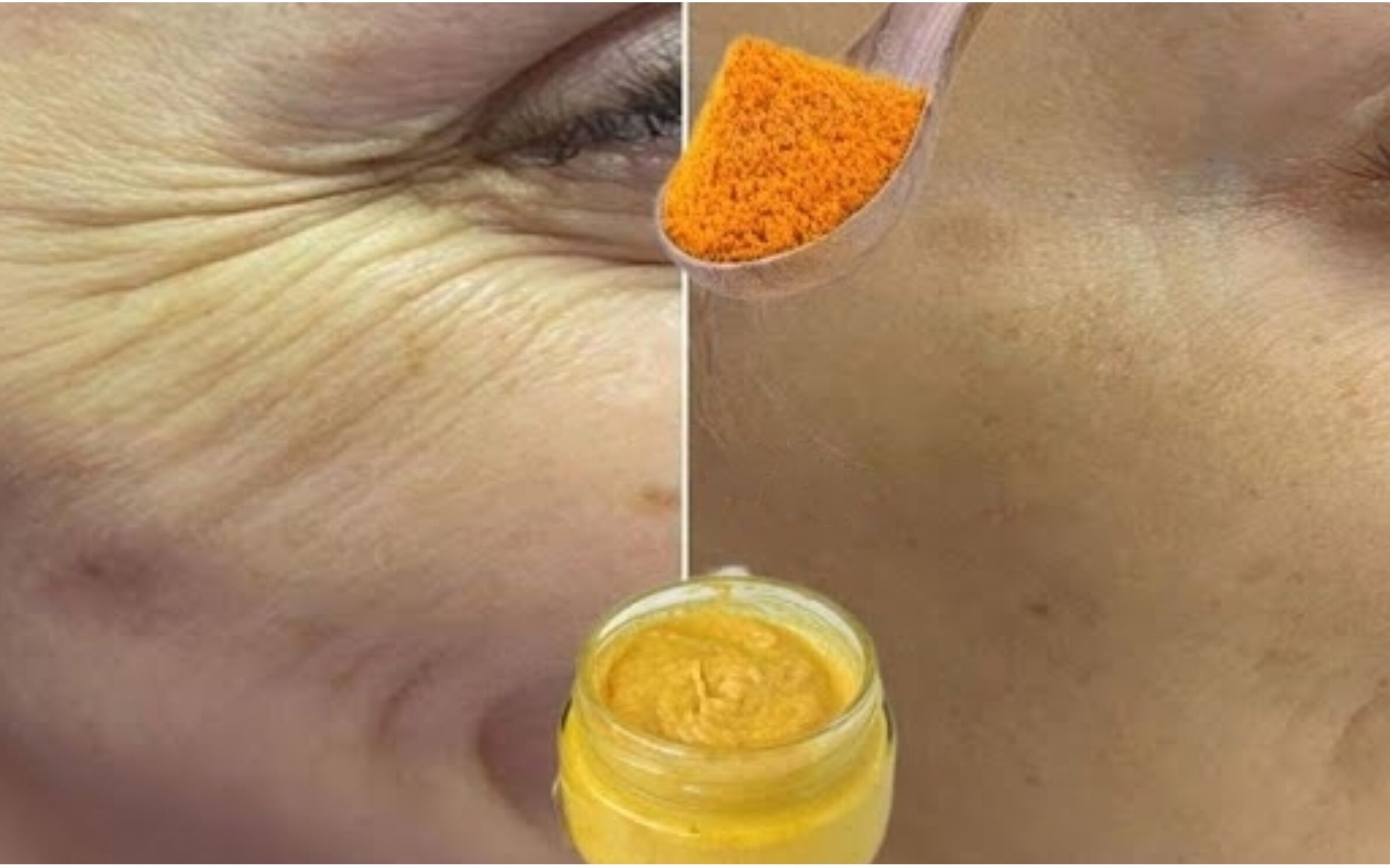 Title: Homemade Turmeric Cream for Radiant Skin: Easy Steps for a Youthful Glow