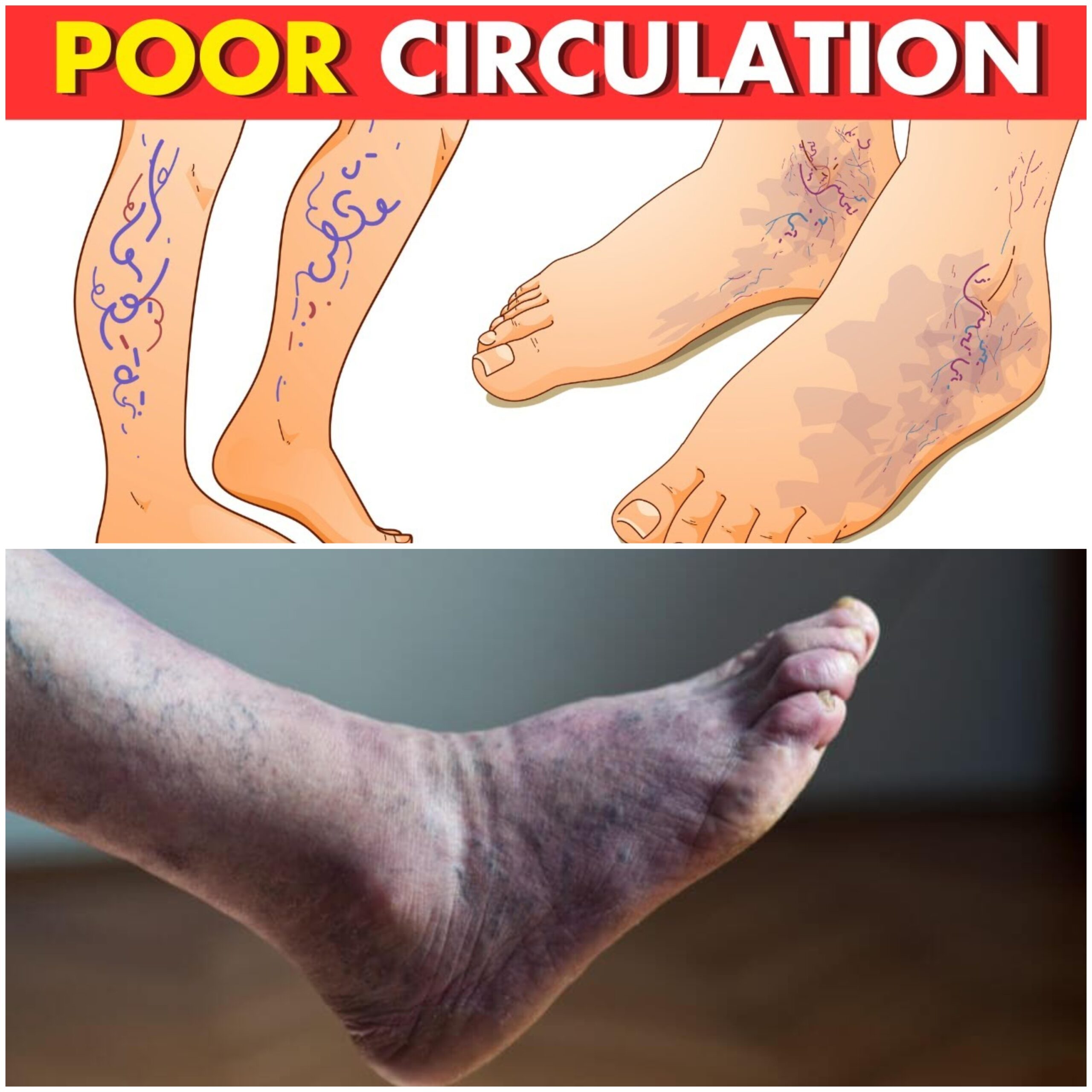 Recognizing Signs of Poor Circulation and Easy Fixes for Better Blood Flow