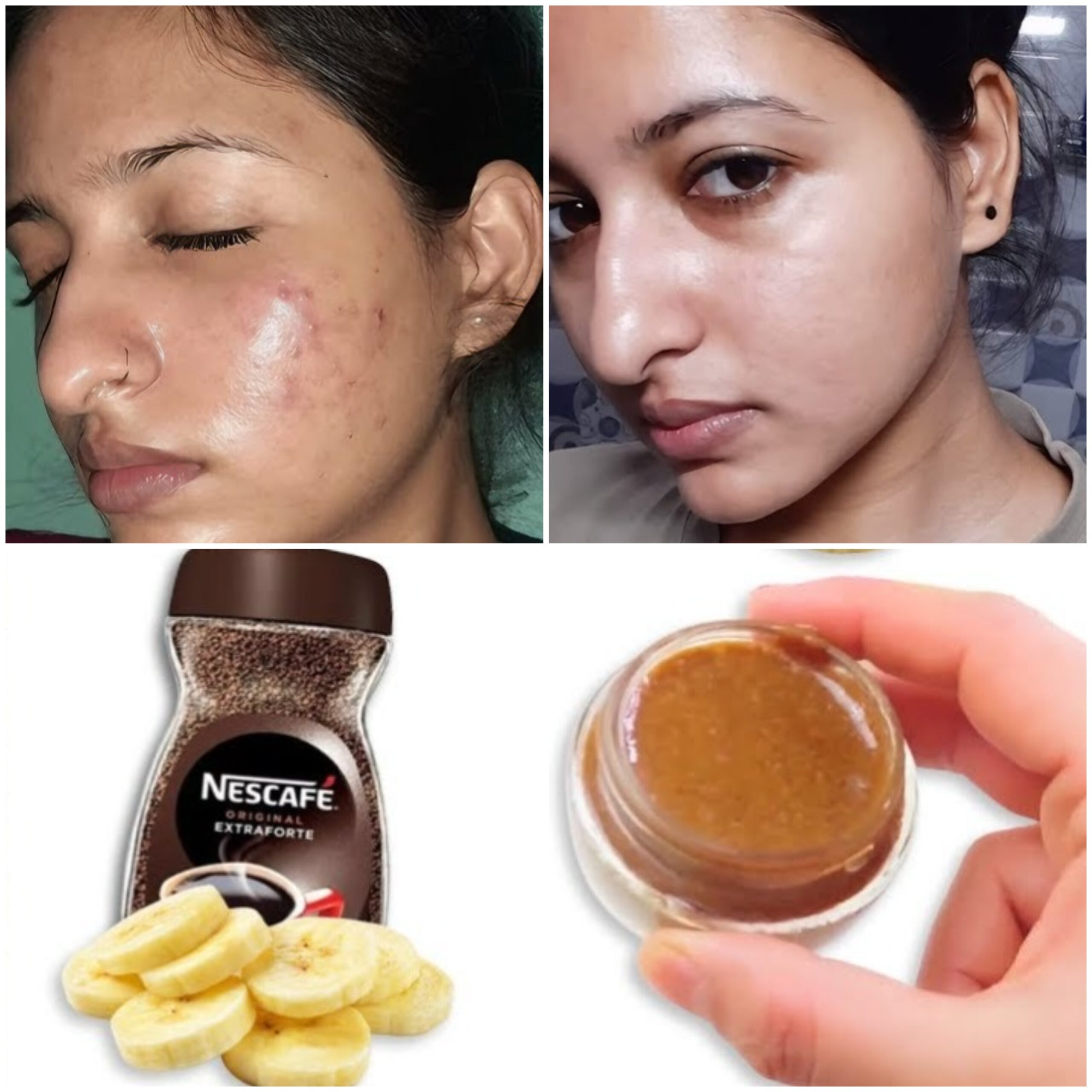 Discover Natural Homemade Remedies for Youthful, Glowing Skin