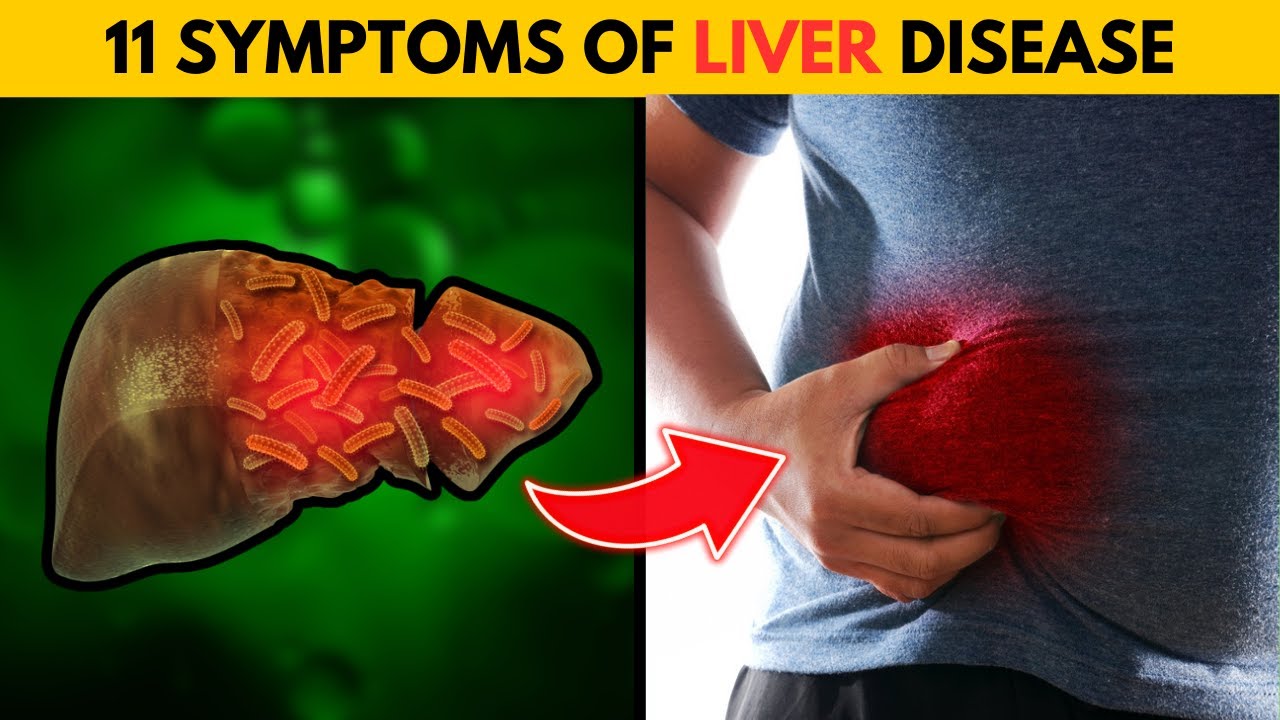 Understanding the Importance of Liver Health: 12 Common Signs to Watch Out For