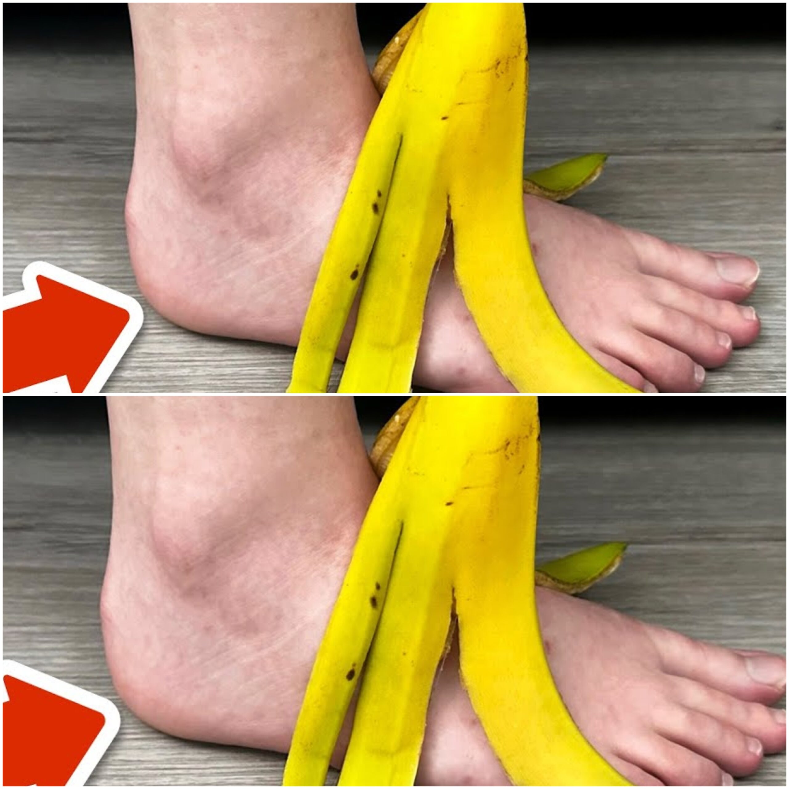 Embracing the Banana Peel Foot Soak: A Surprising Turn to Softness