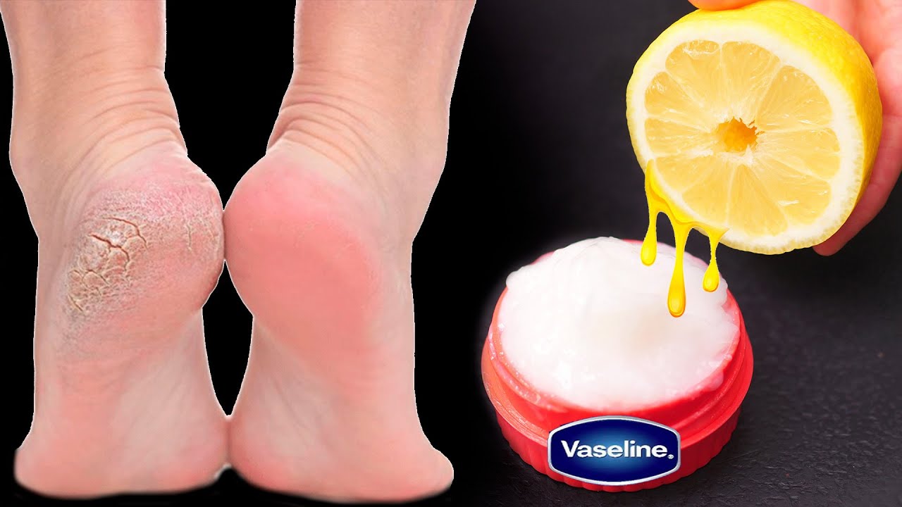 Unlocking the Surprising Benefits of Petroleum Jelly and Lemon: A Game-Changer for Your Skin