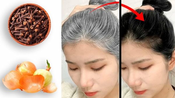 Revitalize Your Hair with the Magic of Cloves and Onions