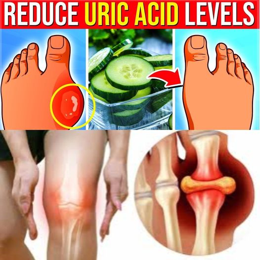 17 Powerful Superfoods to Help Reduce Uric Acid Levels